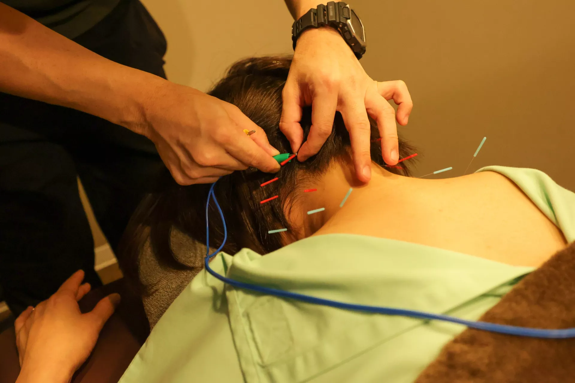 交通事故治療,鍼灸,和泉市,光明池,おすすめ,整骨院31450888_m